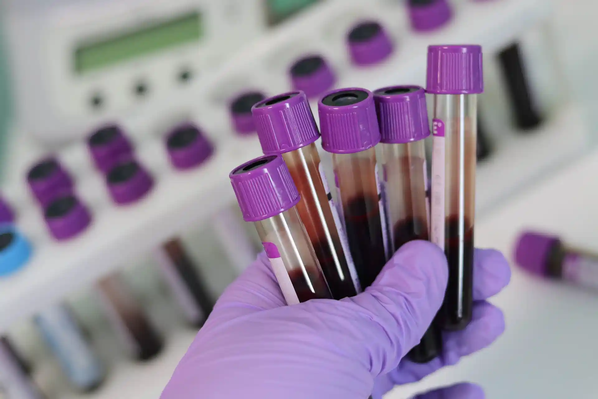 What Can Be Found In Human Blood Can Also Be Found In Urine